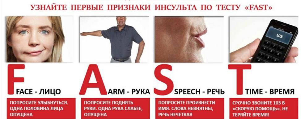 Врачи Регионального сосудистого центра о порядке действий при подозрении на инсульт