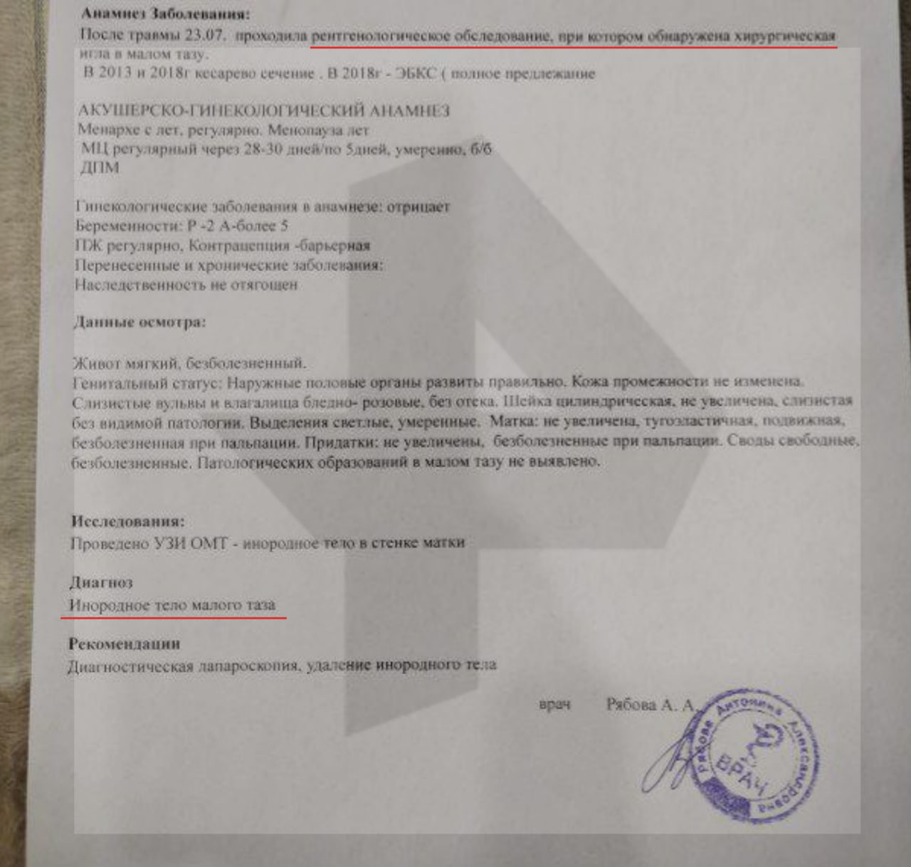 Семь лет с иглой в животе: абаканские врачи забыли инородный предмет в теле женщины Семь лет с иглой в животе: абаканские врачи забыли инородный предмет в теле женщины