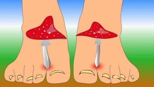 Грибковые инфекции: как распознать и эффективно лечить