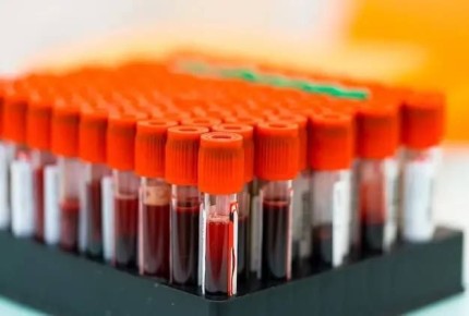 ���������� �������� ����� ������� �� ������� ��������� ����������� �������