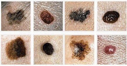 ����� ����� �����������: ��������� � ������� � ����� � ��������